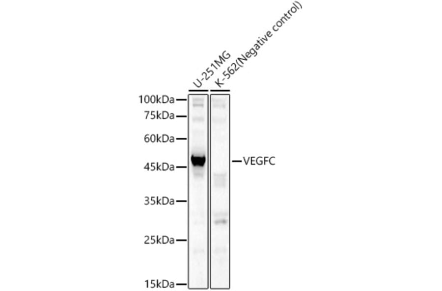 Western Blot - Anti-VEGFC Antibody (A14060) - Antibodies.com