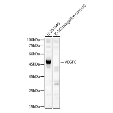 Western Blot - Anti-VEGFC Antibody (A14060) - Antibodies.com