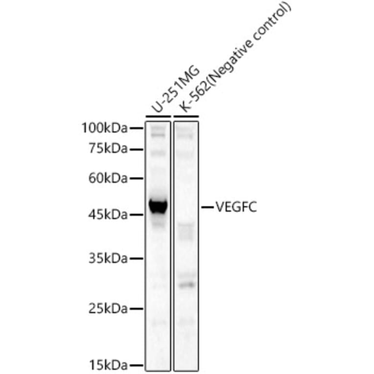 Western Blot - Anti-VEGFC Antibody (A14060) - Antibodies.com