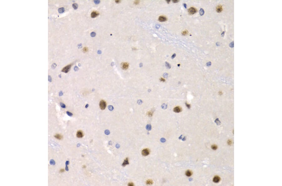 Immunohistochemistry - Anti-IRF2 Antibody (A14061) - Antibodies.com