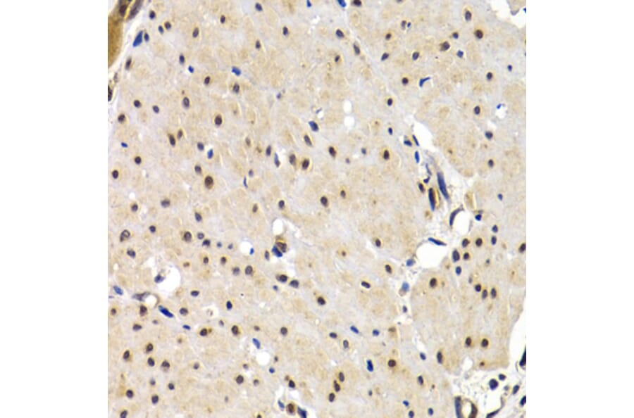 Immunohistochemistry - Anti-IRF2 Antibody (A14061) - Antibodies.com