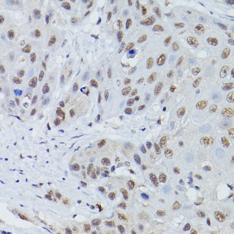Immunohistochemistry - Anti-Mre11 Antibody (A14062) - Antibodies.com