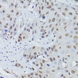 Immunohistochemistry - Anti-Mre11 Antibody (A14062) - Antibodies.com
