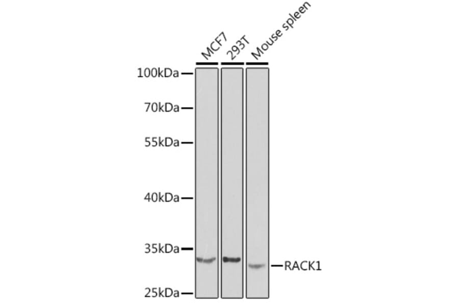 Western Blot - Anti-RACK1 Antibody (A14063) - Antibodies.com