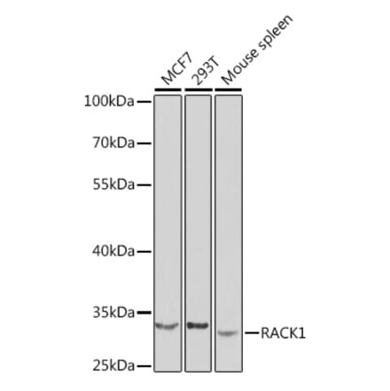 Western Blot - Anti-RACK1 Antibody (A14063) - Antibodies.com