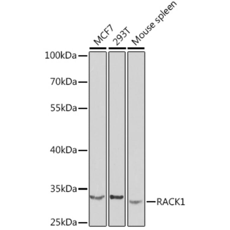 Western Blot - Anti-RACK1 Antibody (A14063) - Antibodies.com