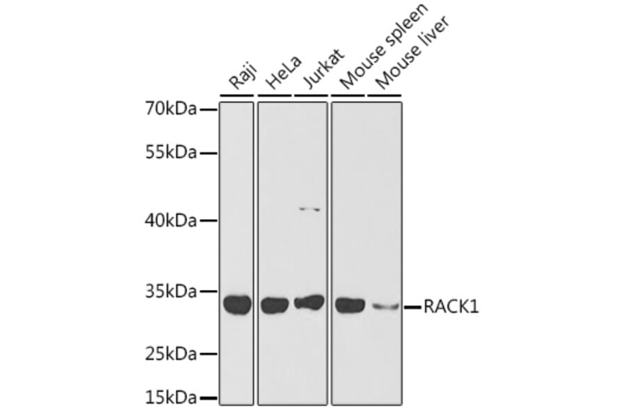 Western Blot - Anti-RACK1 Antibody (A14063) - Antibodies.com
