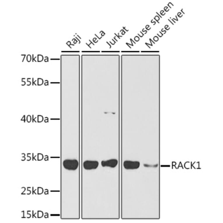 Western Blot - Anti-RACK1 Antibody (A14063) - Antibodies.com