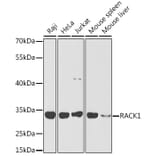 Western Blot - Anti-RACK1 Antibody (A14063) - Antibodies.com