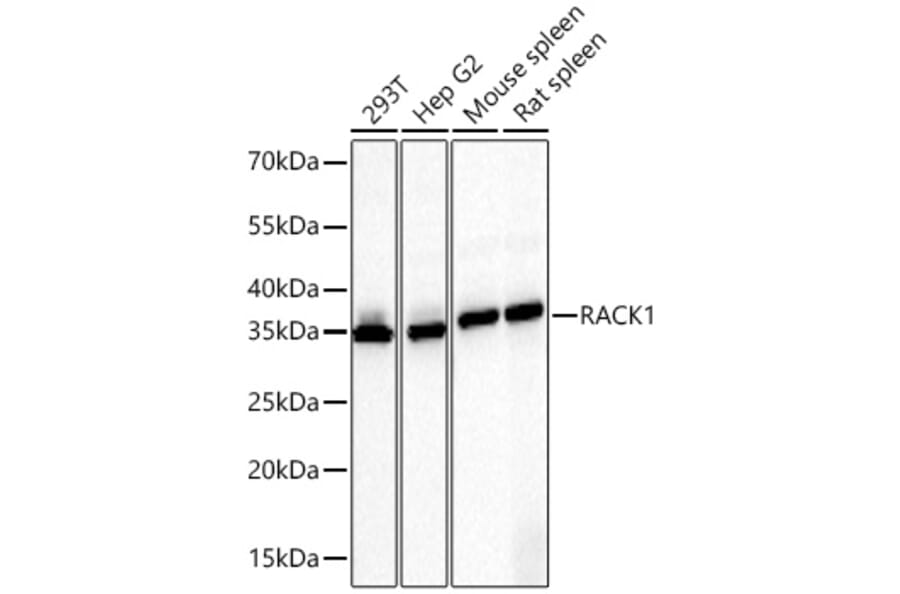 Western Blot - Anti-RACK1 Antibody (A14063) - Antibodies.com