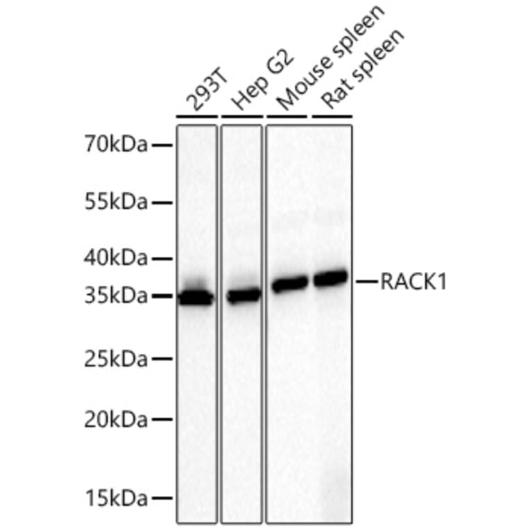 Western Blot - Anti-RACK1 Antibody (A14063) - Antibodies.com