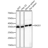 Western Blot - Anti-RACK1 Antibody (A14063) - Antibodies.com