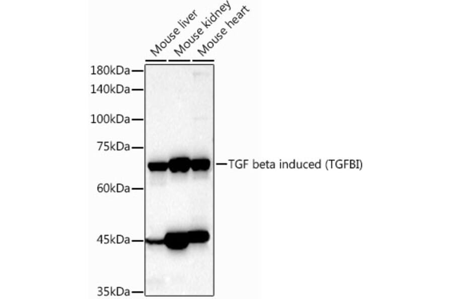 Western Blot - Anti-TGFBI Antibody (A14064) - Antibodies.com