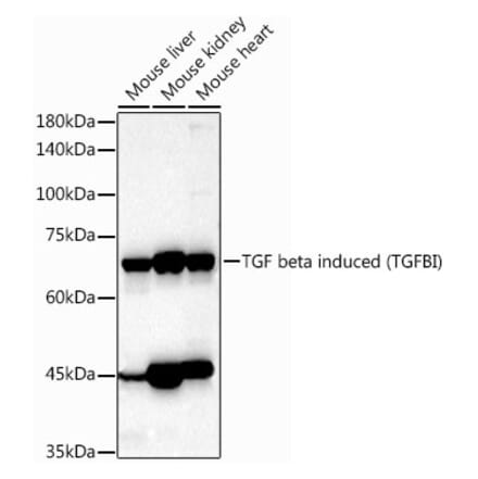 Western Blot - Anti-TGFBI Antibody (A14064) - Antibodies.com