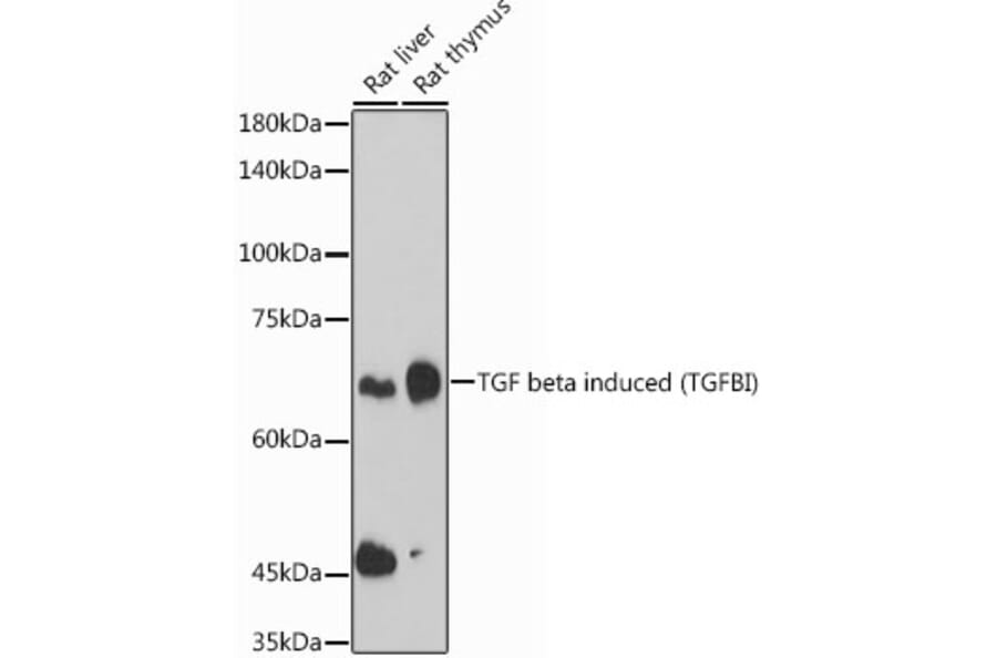 Western Blot - Anti-TGFBI Antibody (A14064) - Antibodies.com
