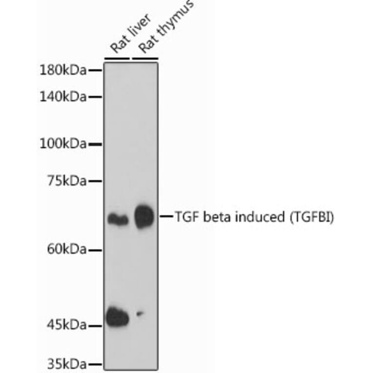 Western Blot - Anti-TGFBI Antibody (A14064) - Antibodies.com