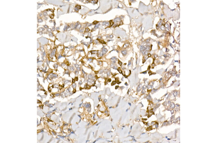 Immunohistochemistry - Anti-TGFBI Antibody (A14064) - Antibodies.com