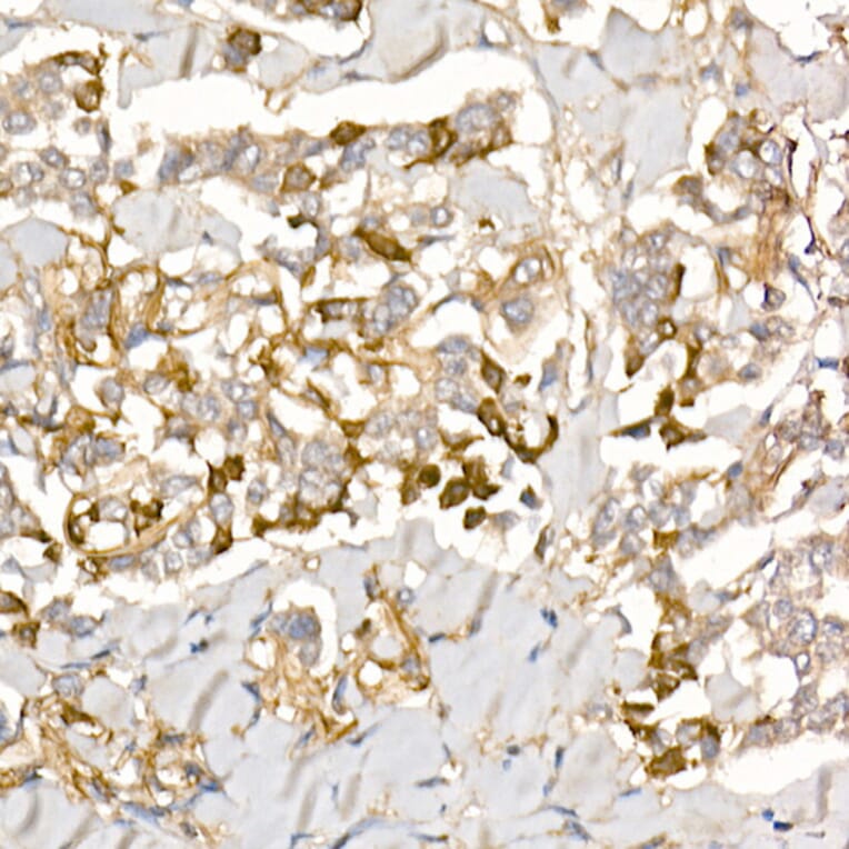 Immunohistochemistry - Anti-TGFBI Antibody (A14064) - Antibodies.com
