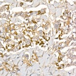 Immunohistochemistry - Anti-TGFBI Antibody (A14064) - Antibodies.com