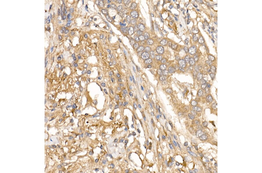 Immunohistochemistry - Anti-TGFBI Antibody (A14064) - Antibodies.com