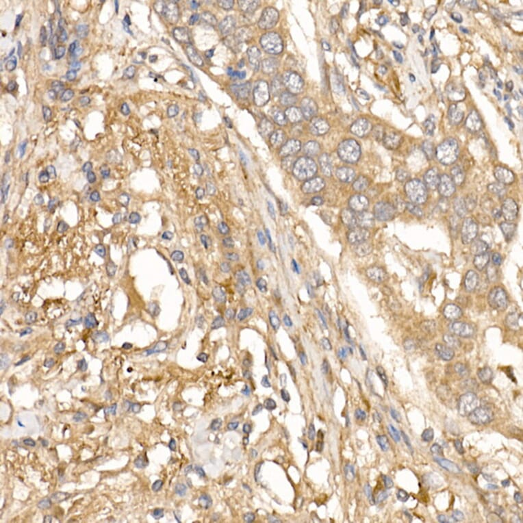 Immunohistochemistry - Anti-TGFBI Antibody (A14064) - Antibodies.com