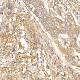 Immunohistochemistry - Anti-TGFBI Antibody (A14064) - Antibodies.com