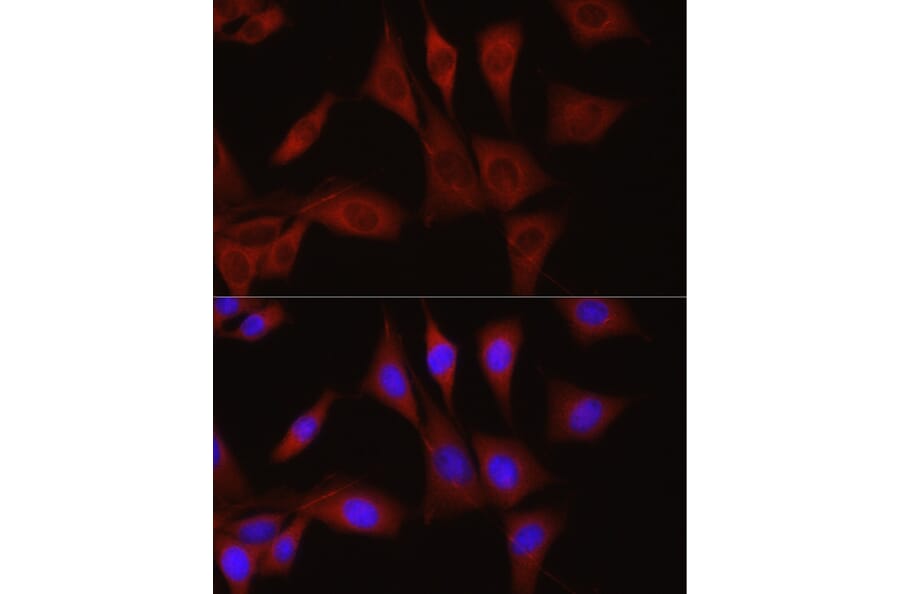 Immunofluorescence - Anti-TGFBI Antibody (A14064) - Antibodies.com