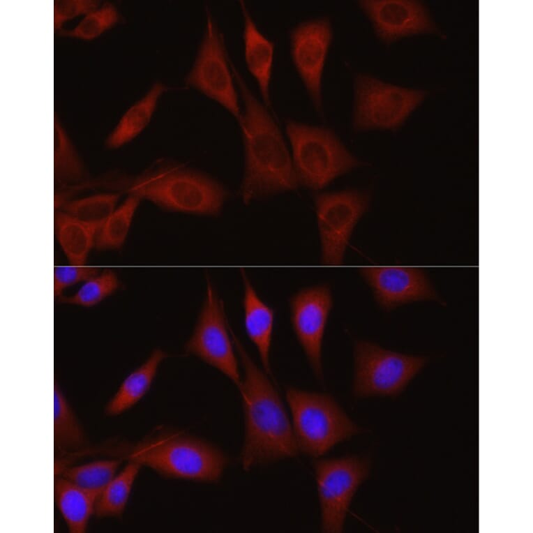 Immunofluorescence - Anti-TGFBI Antibody (A14064) - Antibodies.com