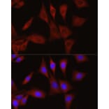 Immunofluorescence - Anti-TGFBI Antibody (A14064) - Antibodies.com