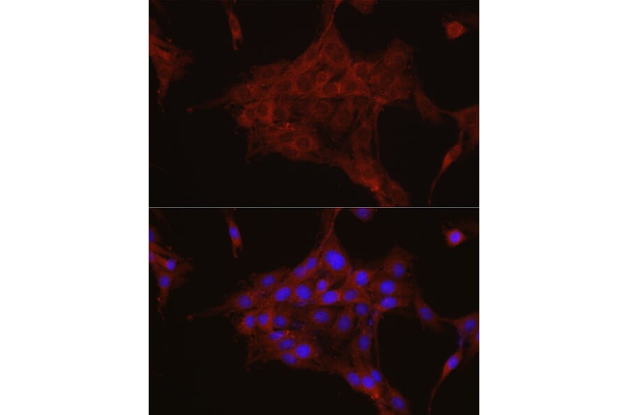 Immunofluorescence - Anti-TGFBI Antibody (A14064) - Antibodies.com
