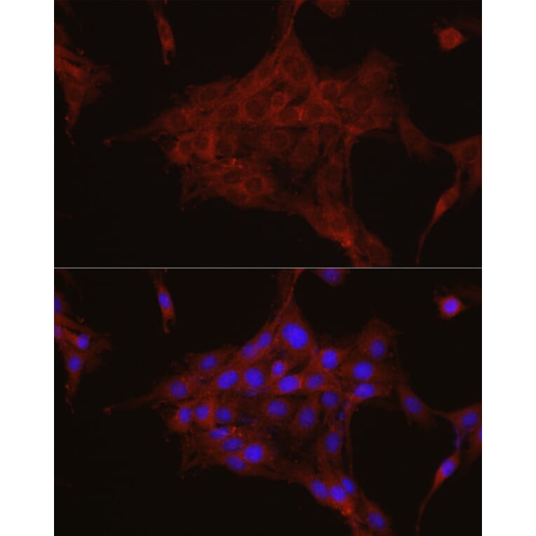 Immunofluorescence - Anti-TGFBI Antibody (A14064) - Antibodies.com