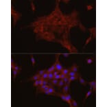 Immunofluorescence - Anti-TGFBI Antibody (A14064) - Antibodies.com
