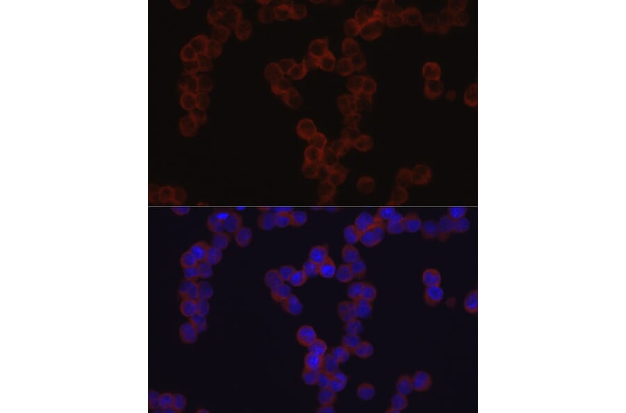 Immunofluorescence - Anti-TGFBI Antibody (A14064) - Antibodies.com