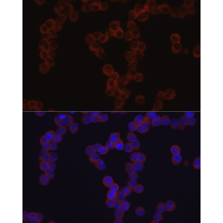 Immunofluorescence - Anti-TGFBI Antibody (A14064) - Antibodies.com