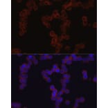 Immunofluorescence - Anti-TGFBI Antibody (A14064) - Antibodies.com