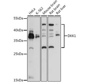 Western Blot - Anti-DKK1 Antibody (A14065) - Antibodies.com