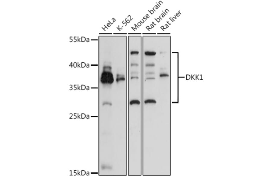 Western Blot - Anti-DKK1 Antibody (A14065) - Antibodies.com