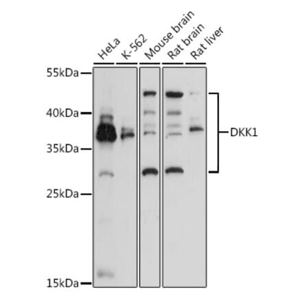 Western Blot - Anti-DKK1 Antibody (A14065) - Antibodies.com