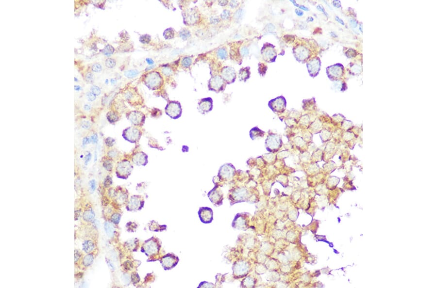 Immunohistochemistry - Anti-Smac/Diablo Antibody (A14067) - Antibodies.com