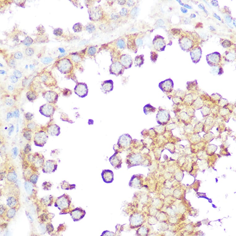 Immunohistochemistry - Anti-Smac/Diablo Antibody (A14067) - Antibodies.com