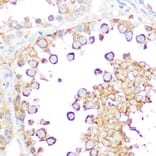 Immunohistochemistry - Anti-Smac/Diablo Antibody (A14067) - Antibodies.com