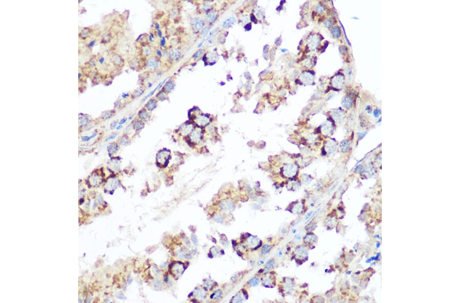 Immunohistochemistry - Anti-Smac/Diablo Antibody (A14067) - Antibodies.com