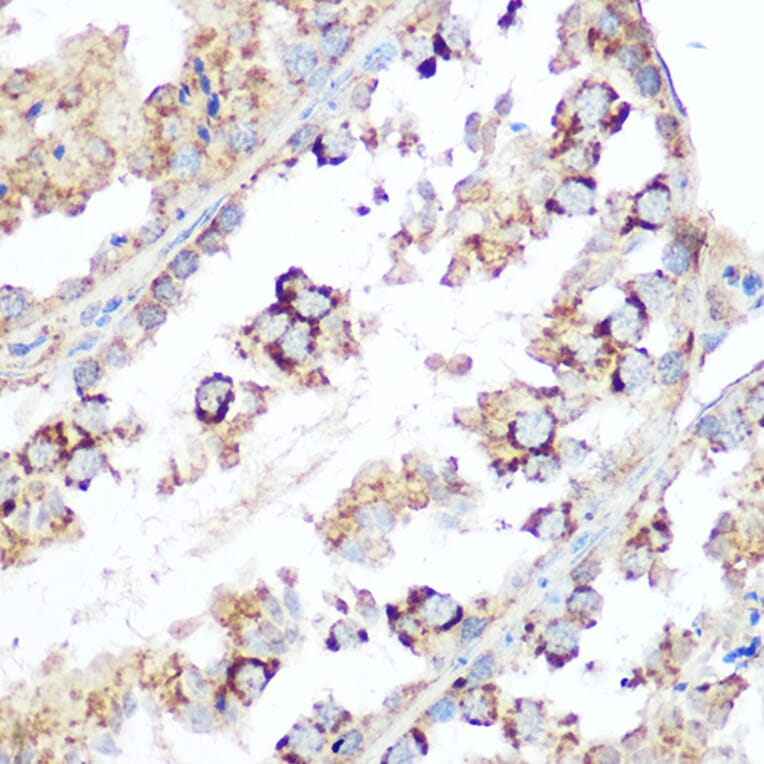Immunohistochemistry - Anti-Smac/Diablo Antibody (A14067) - Antibodies.com