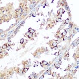 Immunohistochemistry - Anti-Smac/Diablo Antibody (A14067) - Antibodies.com