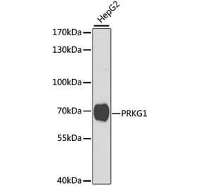 Western Blot - Anti-cGKI Antibody (A14068) - Antibodies.com