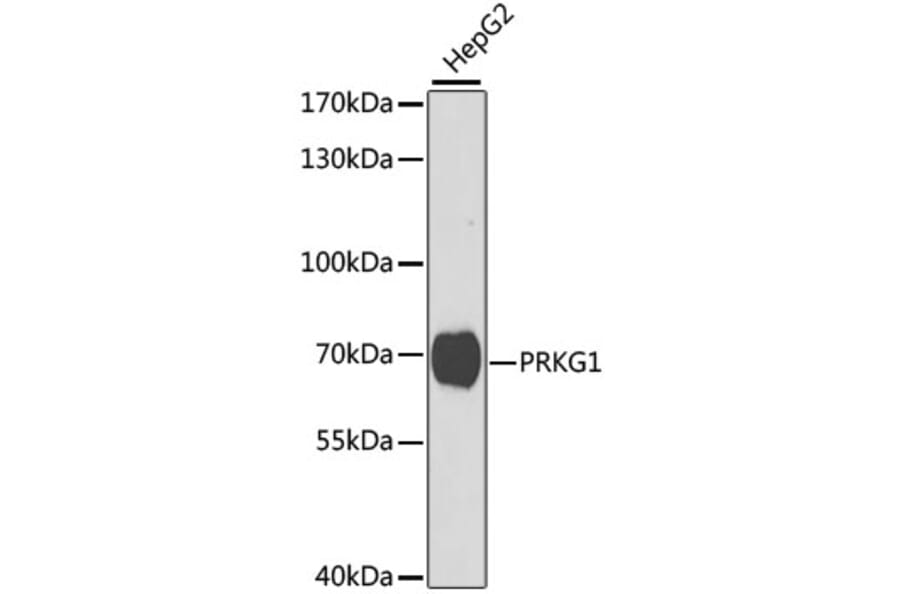Western Blot - Anti-cGKI Antibody (A14068) - Antibodies.com
