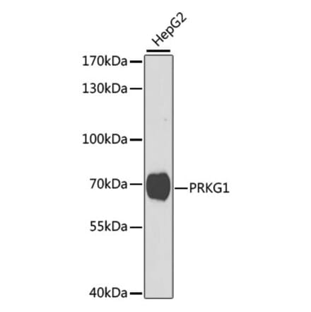 Western Blot - Anti-cGKI Antibody (A14068) - Antibodies.com