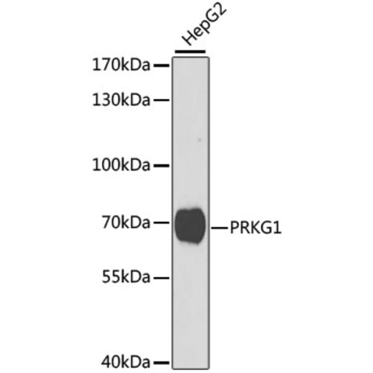 Western Blot - Anti-cGKI Antibody (A14068) - Antibodies.com