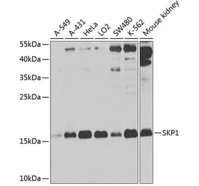 Western Blot - Anti-Skp1 Antibody (A14069) - Antibodies.com