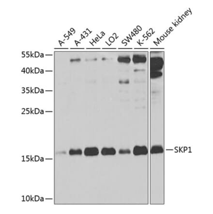 Western Blot - Anti-Skp1 Antibody (A14069) - Antibodies.com